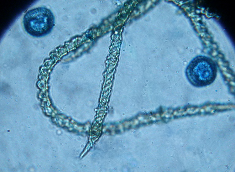 Trichia sp. ?